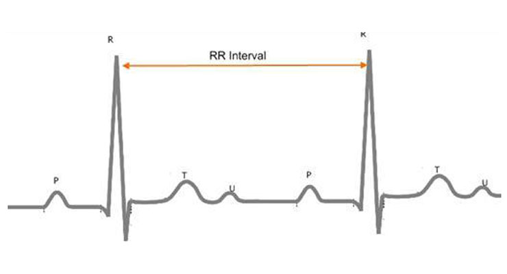 CAST RR Interval Sub-Study Database