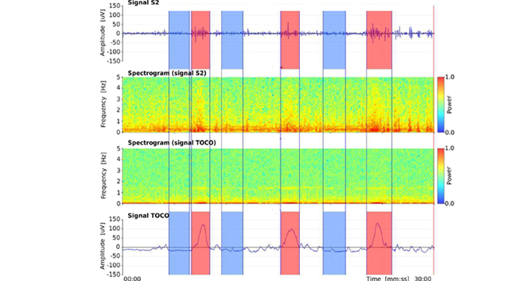 Term-Preterm EHG DataSet with Tocogram