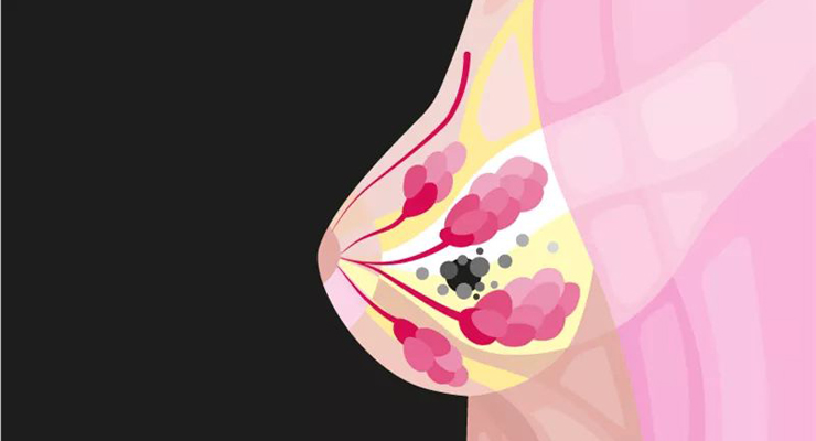 乳腺摄影海量数据集