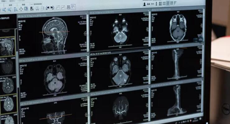 上腹部DICOM数据包括多个脏器的Label