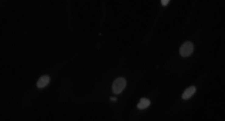 从组织学图像识别细胞核，组织学图像数据集