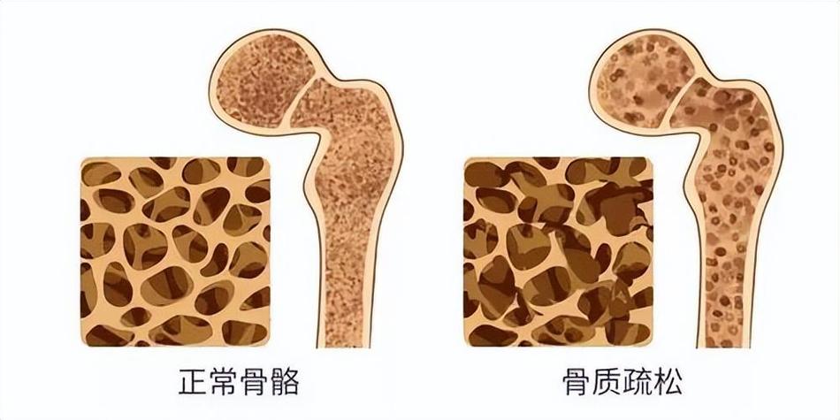 骨骼点数据集