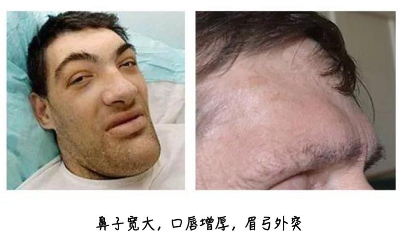 人脸异常检测数据集