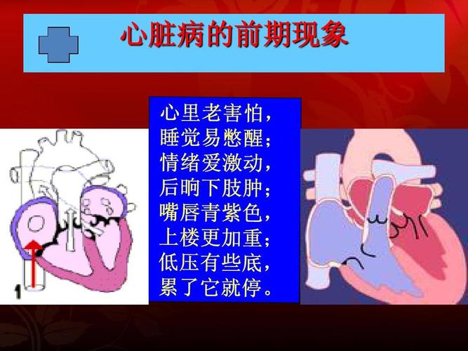 医疗保健：心脏病发作的可能性数据集