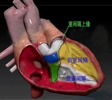 RVSC右心室分割数据集