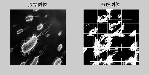 UW-Madison 胃肠道图像分割数据集