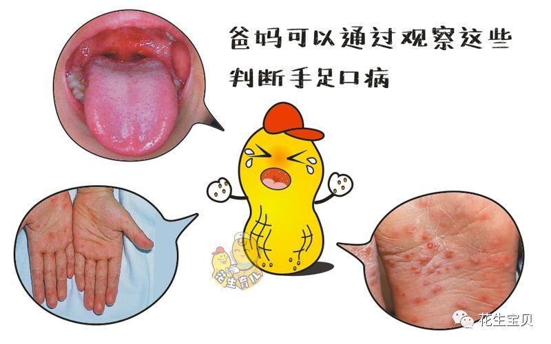 新冠疫情预测数据集