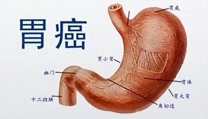 乳腺癌未划分数据集