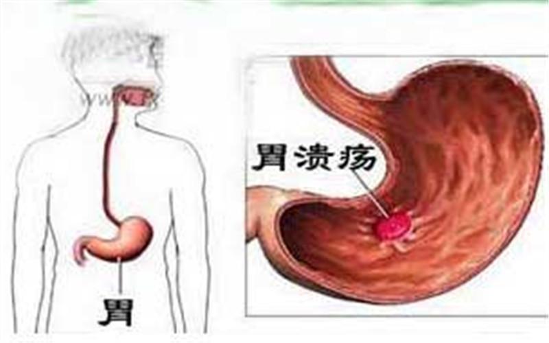 非标准化疾病诉求2.0数据集