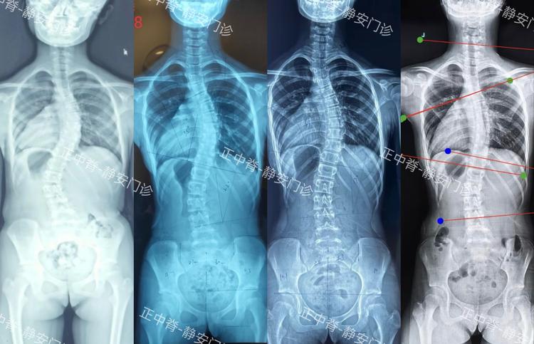 科大讯飞-X光安检图像检测挑战赛3.0数据集