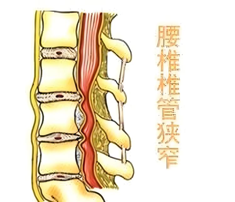 T2腰椎矢状位椎间盘目标检测数据VOC