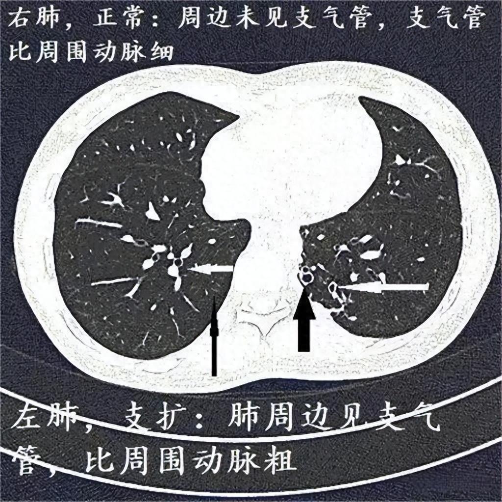 肺、心脏和气管的CT图像分割数据集